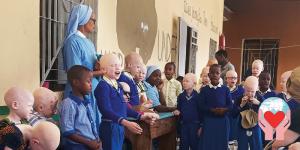 bambini africani albini